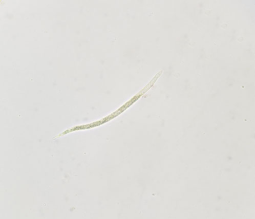 edit-Fig 6- Root-knot nematode J2 original 2